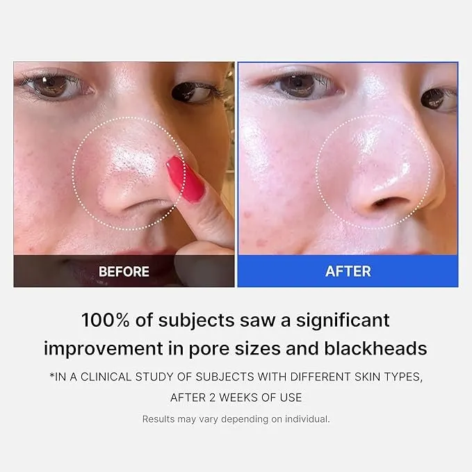 Medicube zero pore pad للمسام و الرؤوس السوداء 