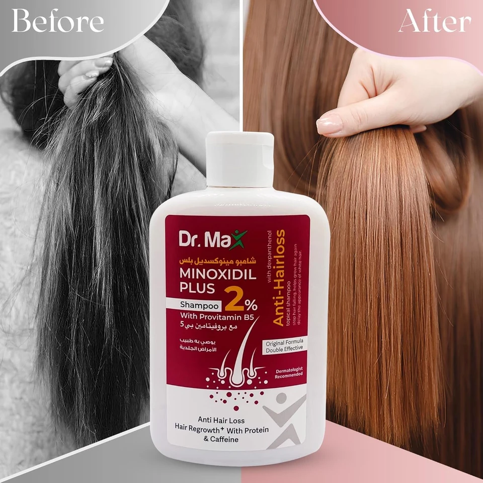 Dr Max Minoxidil Plus 2% Shampoo With Provitamin B5 (Dexpanthenol) Anti Hair Loss, Hair Regrowth With Protein & Caffeine