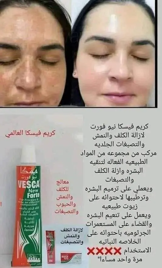 كريم فيسكا