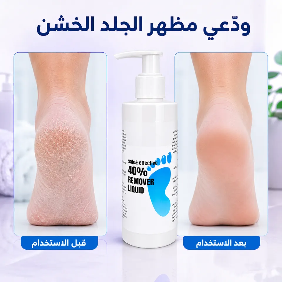جل مزيل الجلد الميت والكالو (250 مل) 
