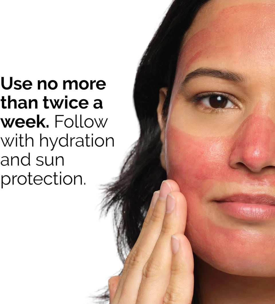 The Ordinary AHA 30% + BHA 2% Peeling Solution, Advanced Exfoliating Peel for Brighter Skin